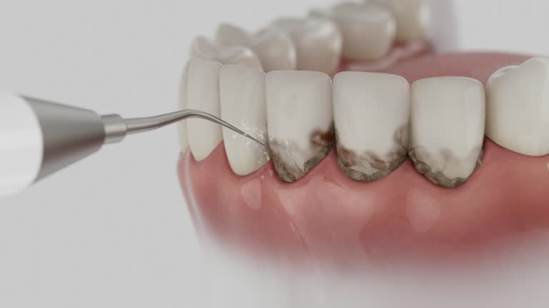 Reliable Wisdom Tooth Removal contractor in Pickaway County County, OH by Dentist Open Now